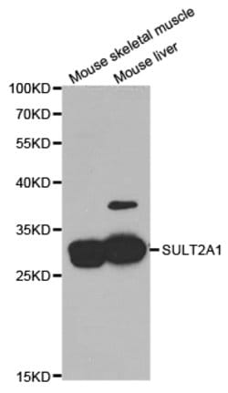 Invitrogen SULT2A1 Polyclonal Antibody 100 &mu;L; Unconjugated:Antibodies,