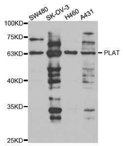 Invitrogen™ tPA Polyclonal Antibody