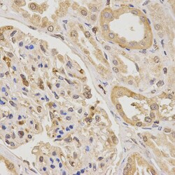 Invitrogen UTS2 Polyclonal Antibody 100 &mu;L; Unconjugated:Antibodies,