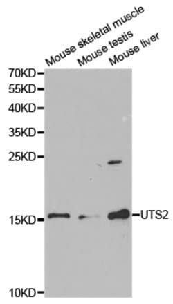 Invitrogen UTS2 Polyclonal Antibody 100 &mu;L; Unconjugated:Antibodies,