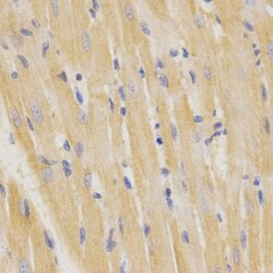 Invitrogen SFTPC Polyclonal Antibody 100 &mu;L; Unconjugated:Antibodies,