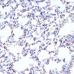 Invitrogen SFTPC Polyclonal Antibody 100 &mu;L; Unconjugated:Antibodies,