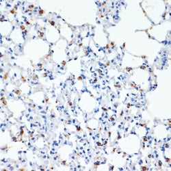 Invitrogen SFTPC Polyclonal Antibody 100 &mu;L; Unconjugated:Antibodies,
