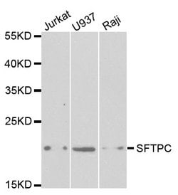 Invitrogen SFTPC Polyclonal Antibody 100 &mu;L; Unconjugated:Antibodies,