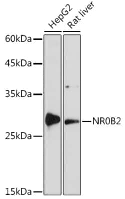 Invitrogen NR0B2 Polyclonal Antibody 100 &mu;L; Unconjugated:Antibodies,