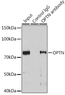 Invitrogen Optineurin Polyclonal Antibody 100 &mu;L; Unconjugated:Antibodies,