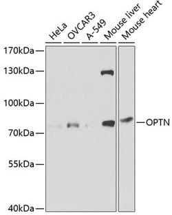 Invitrogen Optineurin Polyclonal Antibody 100 &mu;L; Unconjugated:Antibodies,