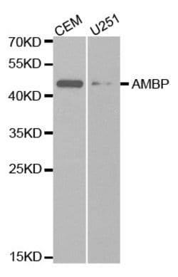 Invitrogen alpha-1 Microglobulin Polyclonal Antibody 100 &mu;L; Unconjugated:Antibodies,