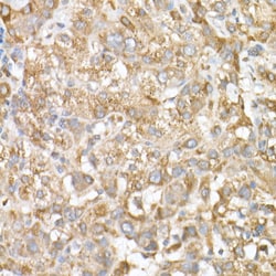 Invitrogen GLB1 Polyclonal Antibody 100 &mu;L | Buy Online | Invitrogen&trade; | Fisher Scientific