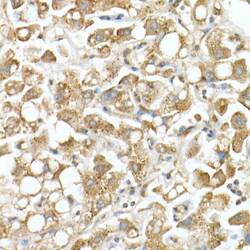 Invitrogen GLB1 Polyclonal Antibody 100 &mu;L | Buy Online | Invitrogen&trade; | Fisher Scientific