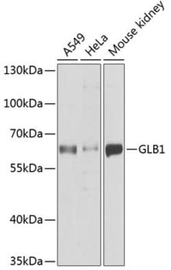 Invitrogen GLB1 Polyclonal Antibody 100 &mu;L | Buy Online | Invitrogen&trade; | Fisher Scientific