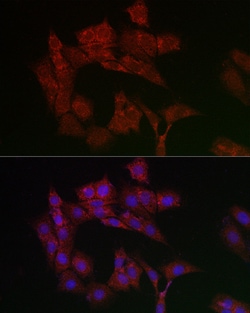 Invitrogen ANT Polyclonal Antibody 100 &mu;L; Unconjugated:Antibodies,