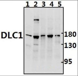 Invitrogen DLC1 Polyclonal Antibody 100 &mu;L; Unconjugated:Antibodies,