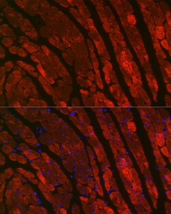 Cardiac Troponin C Polyclonal Antibody:Antibodies, Polyclonal