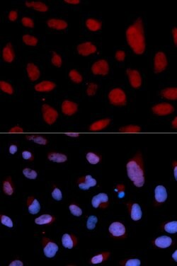Cardiac Troponin C Polyclonal Antibody:Antibodies, Polyclonal