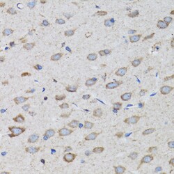 Invitrogen PSMD10 Polyclonal Antibody 100 &mu;L | Buy Online | Invitrogen&trade; | Fisher Scientific