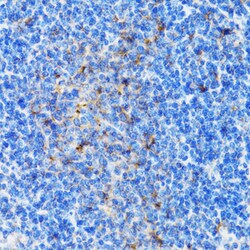 Invitrogen PSMD10 Polyclonal Antibody 100 &mu;L | Buy Online | Invitrogen&trade; | Fisher Scientific