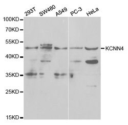 Invitrogen KCNN4 Polyclonal Antibody 100 &mu;L; Unconjugated:Antibodies,