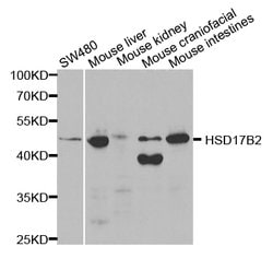 Invitrogen HSD17B2 Polyclonal Antibody 100 &mu;L; Unconjugated:Antibodies,