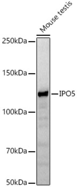 Invitrogen IPO5 Polyclonal Antibody 100 &mu;L | Buy Online | Invitrogen&trade; | Fisher Scientific
