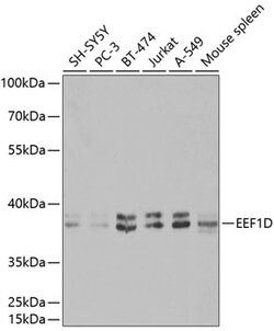 Invitrogen EEF1D Polyclonal Antibody 100 &mu;L; Unconjugated:Antibodies,
