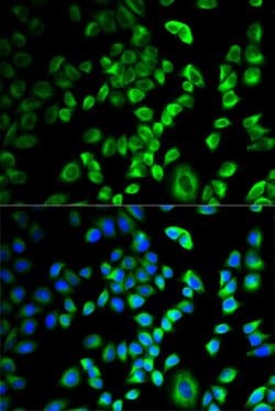 Invitrogen SERPINH1 Polyclonal Antibody 100 &mu;L; Unconjugated:Antibodies,