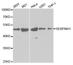Invitrogen SERPINH1 Polyclonal Antibody 100 &mu;L; Unconjugated:Antibodies,