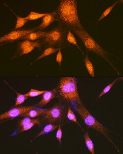 Invitrogen PCBP2 Polyclonal Antibody 100 &mu;L; Unconjugated:Antibodies,
