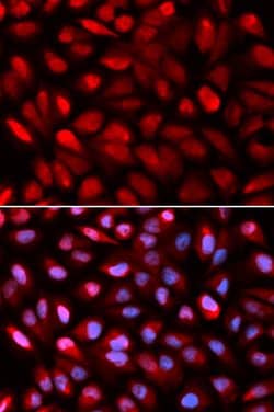 Invitrogen PCBP2 Polyclonal Antibody 100 &mu;L; Unconjugated:Antibodies,