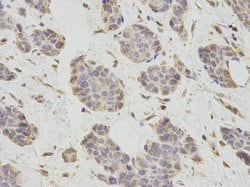 Invitrogen PCBP2 Polyclonal Antibody 100 &mu;L; Unconjugated:Antibodies,