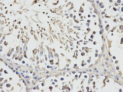 Invitrogen RPS3 Polyclonal Antibody 100 &mu;L; Unconjugated:Antibodies,