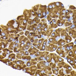 Invitrogen RPS3 Polyclonal Antibody 100 &mu;L; Unconjugated:Antibodies,
