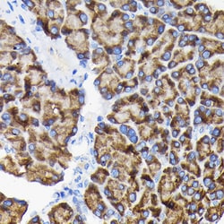 Invitrogen RPS3 Polyclonal Antibody 100 &mu;L; Unconjugated:Antibodies,