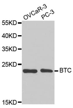 Invitrogen betacellulin Polyclonal Antibody 100 &mu;L; Unconjugated:Antibodies,