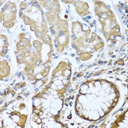 Invitrogen NRG4 Polyclonal Antibody 100 &mu;L; Unconjugated:Antibodies,