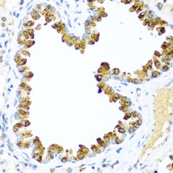 Invitrogen NRG4 Polyclonal Antibody 100 &mu;L; Unconjugated:Antibodies,