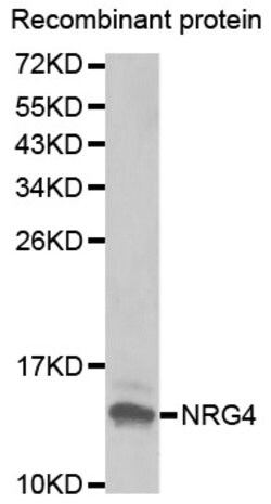 Invitrogen NRG4 Polyclonal Antibody 100 &mu;L; Unconjugated:Antibodies,