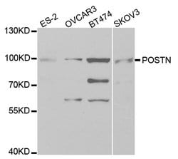 Invitrogen Periostin Polyclonal Antibody 100 &mu;L; Unconjugated:Antibodies,