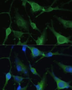 Invitrogen&trade;&nbsp;FABP7 Polyclonal Antibody