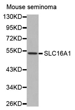 Invitrogen MCT1 Polyclonal Antibody 100 &mu;L; Unconjugated:Antibodies,