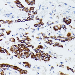 Invitrogen MMP25 Polyclonal Antibody 100 &mu;L; Unconjugated:Antibodies,