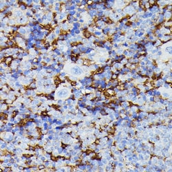 Invitrogen MMP25 Polyclonal Antibody 100 &mu;L; Unconjugated:Antibodies,