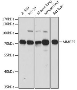 Invitrogen MMP25 Polyclonal Antibody 100 &mu;L; Unconjugated:Antibodies,