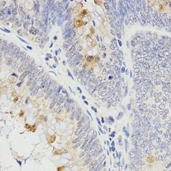 Invitrogen RAMP2 Polyclonal Antibody 100 &mu;L; Unconjugated:Antibodies,