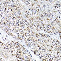 Invitrogen RAMP2 Polyclonal Antibody 100 &mu;L; Unconjugated:Antibodies,
