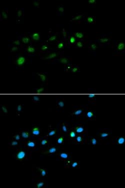 Invitrogen MURF1 Polyclonal Antibody 100 &mu;L; Unconjugated:Antibodies,