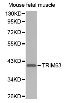 Invitrogen MURF1 Polyclonal Antibody 100 &mu;L; Unconjugated:Antibodies,