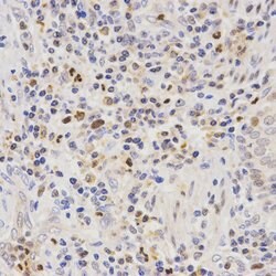 Invitrogen SCTR Polyclonal Antibody 100 &mu;L; Unconjugated:Antibodies,
