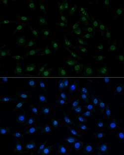 Invitrogen MNAR Polyclonal Antibody 100 &mu;L; Unconjugated:Antibodies,