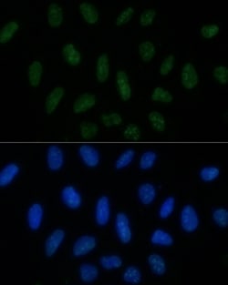 Invitrogen MNAR Polyclonal Antibody 100 &mu;L; Unconjugated:Antibodies,